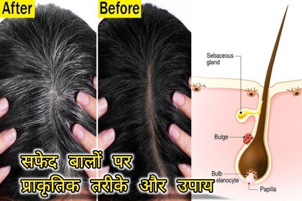 white hair nature remedy images | safed balo par upay images |