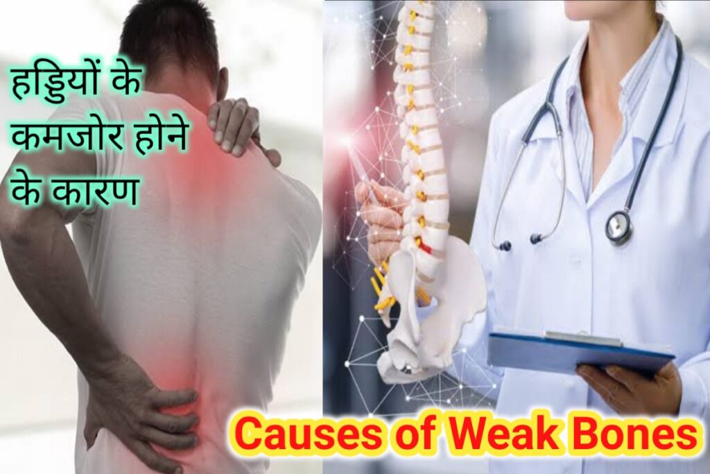 causes of weak bones images | body bones weak reason images |