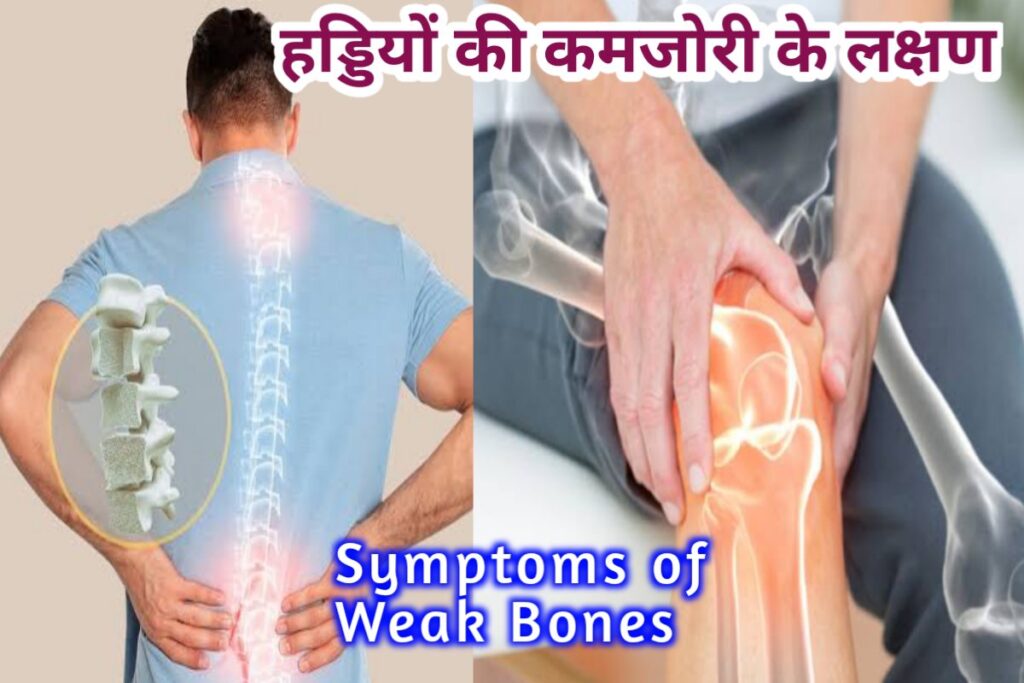 symptoms of weak bones images | bones symptoms of weak images |